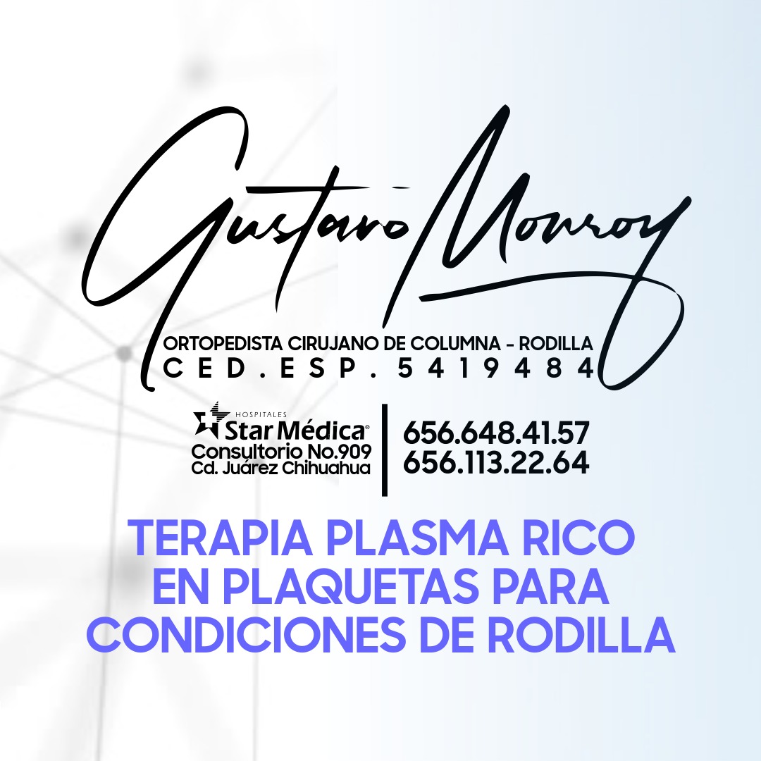 Instalación 1