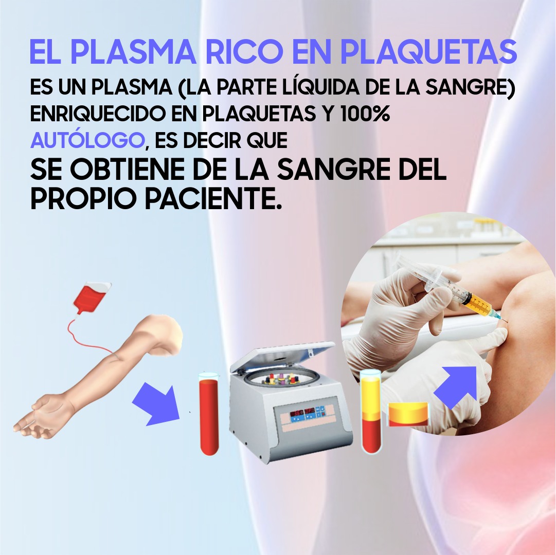 Instalación 2